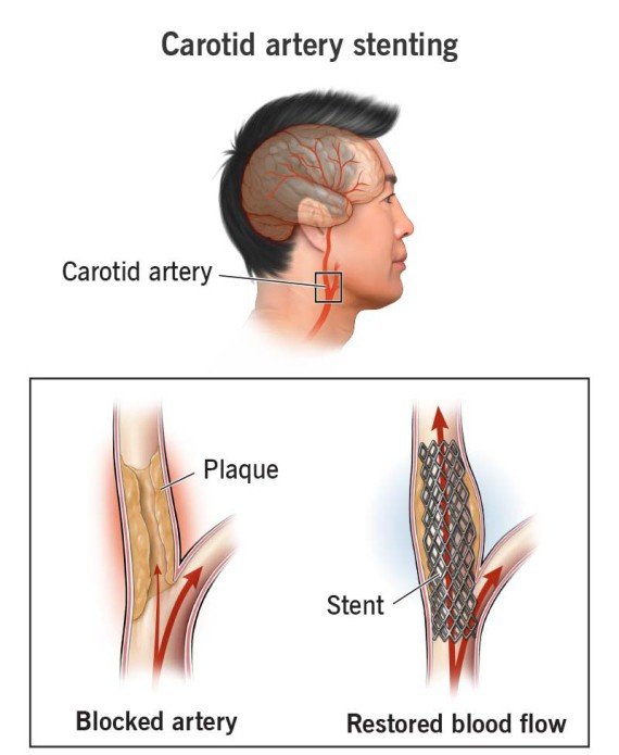 Interventional Radiology Equipment